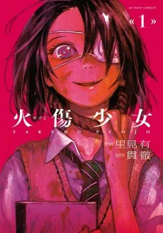 火傷少女